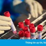 Chuỗi lây nhiễm xưởng cơ khí ở Hóc Môn tăng lên 36 người