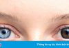 Màu mắt nào phổ biến nhất thế giới?
