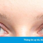 Màu mắt nào phổ biến nhất thế giới?